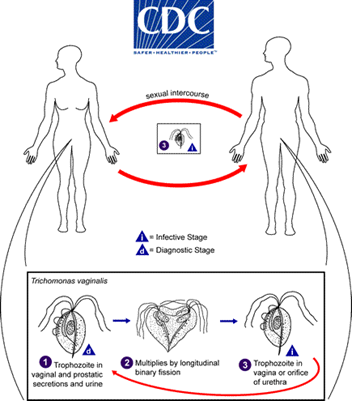 Trichomoniasis (Trich) 